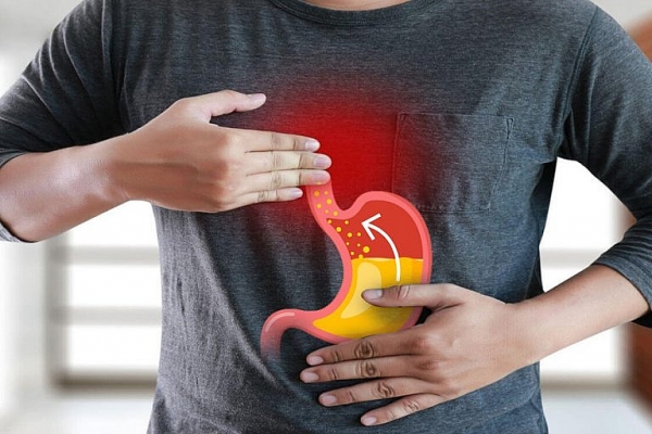 Cách chữa trào ngược dạ dày gây ho